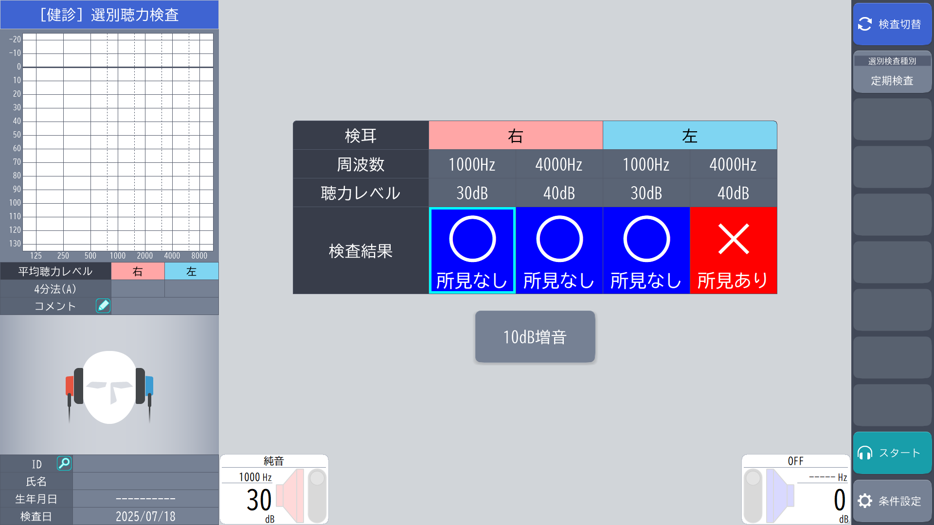 選別聴力検査