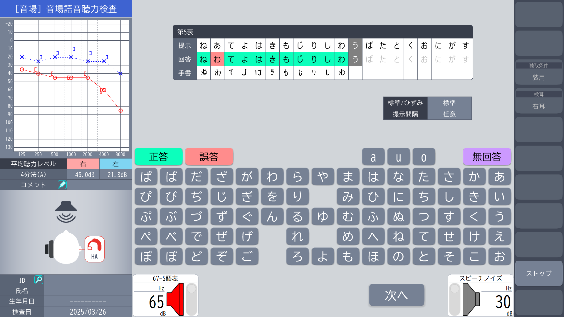 音場語音聴力検査