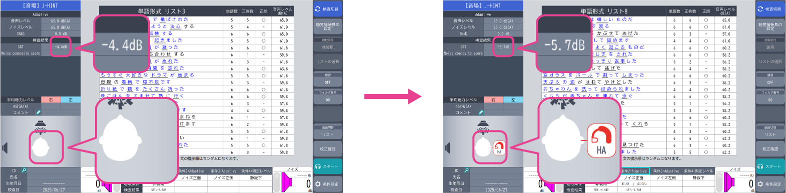 聴覚補装具の装用/非装用の比較