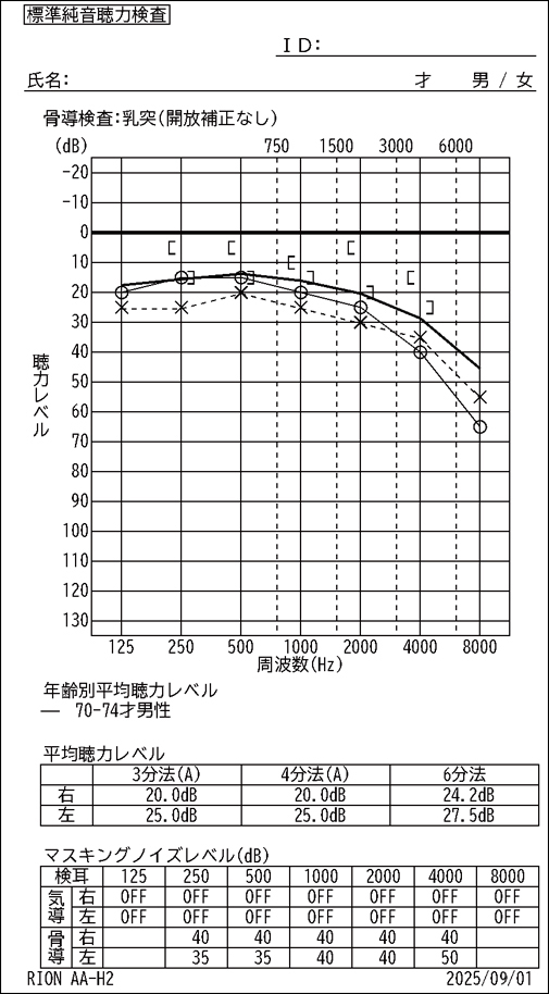 感熱プリンタによる印刷